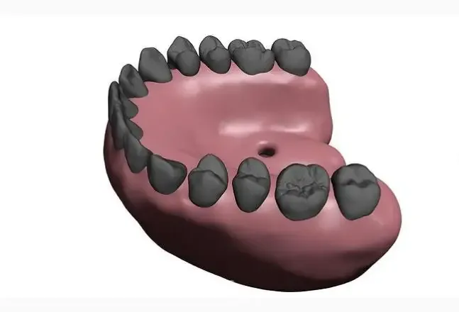 3d printer medical advances