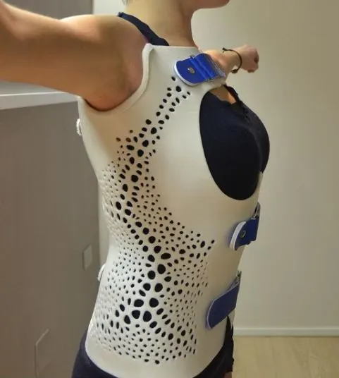 3d printer medical device