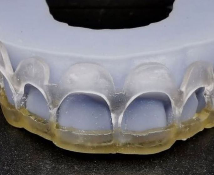 how could a 3d printer be used by the medical industry