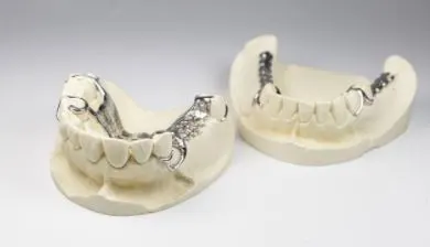 3d printed teeth cost